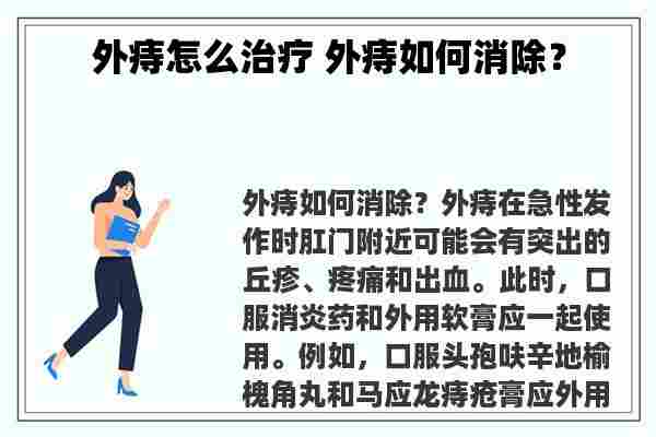 外痔怎么治疗 外痔如何消除？